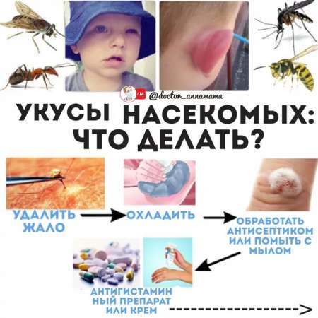 Что делать, если ребенка укусила мошка, комар или пчела?